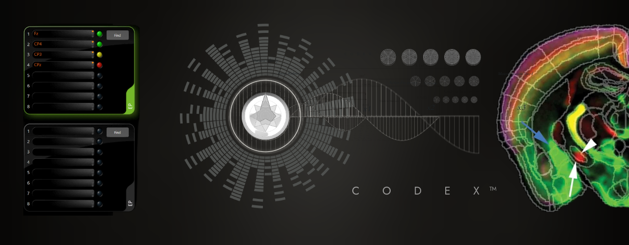 El síndrome moderno de la amígdala hiper-estimulada.