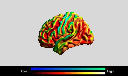 El síndrome moderno de la amígdala hiper-estimulada.