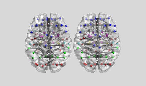 El síndrome moderno de la amígdala hiper-estimulada.